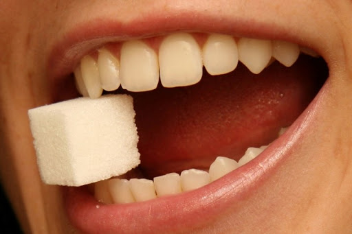 Стоматологи назвали незвичні причини пожовтіння зубів